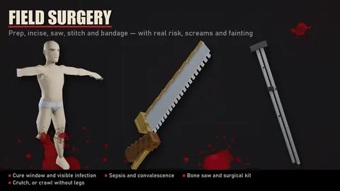 The Only Cure+ - Полевая хирургия и модульные протезы для Project Zomboid
